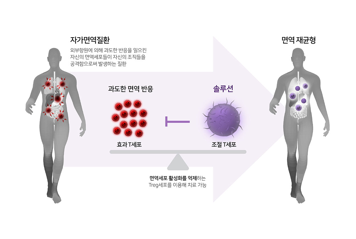 면역세포 활성화를 억제하는 Treg세포를 이용해 치료 가능